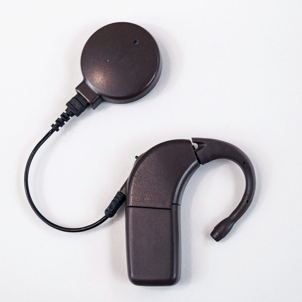 Advanced Bionics cochlear implant processor BTE