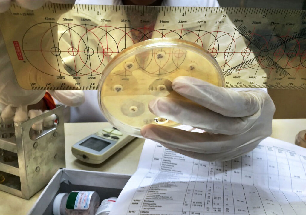 The disk diffusion method of bacterial identification and antibiotic sensitivity testing